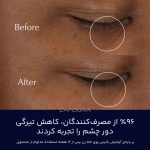 کرم دور چشم ادونس نایت ریپیر استی لودر - Image 3